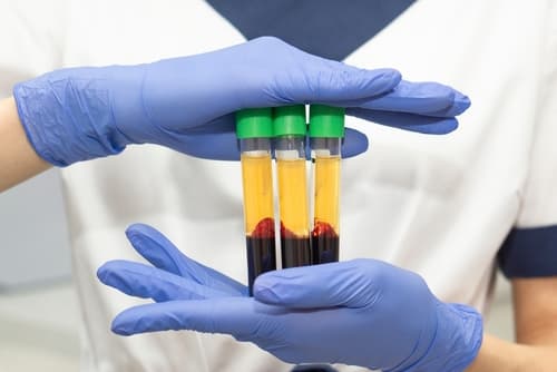 Platelet-Rich Plasma Injection
